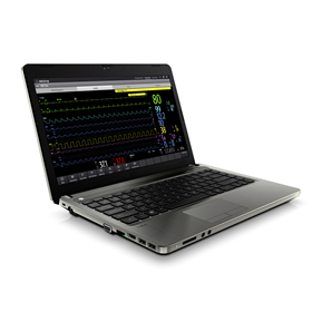 BeneVision CMS Viewer